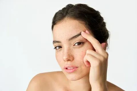 Understanding Brow Lift Surgery in Riyadh for Improved Facial Harmony